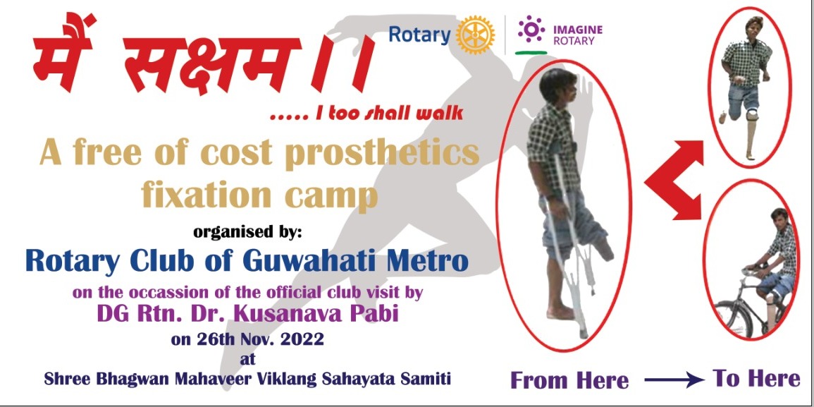 A free of cost prosthetics fixation camp
